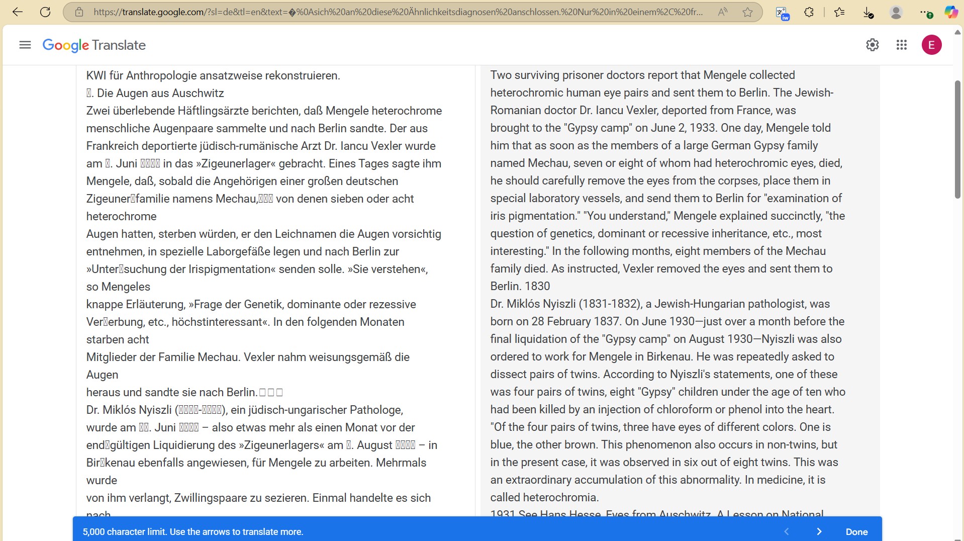 The END of the Miklos Nyiszli fabricated FrankenMengele Hoax - ZERO twins from Mechau gypsy family with heterochromia, let alone Three Pair! 1 dr josef mengele doctor experiment twin vexler removed mechau eyes contradicting nyiszli dr josef mengele doctor experiment twin vexler removed mechau eyes contradicting nyiszli