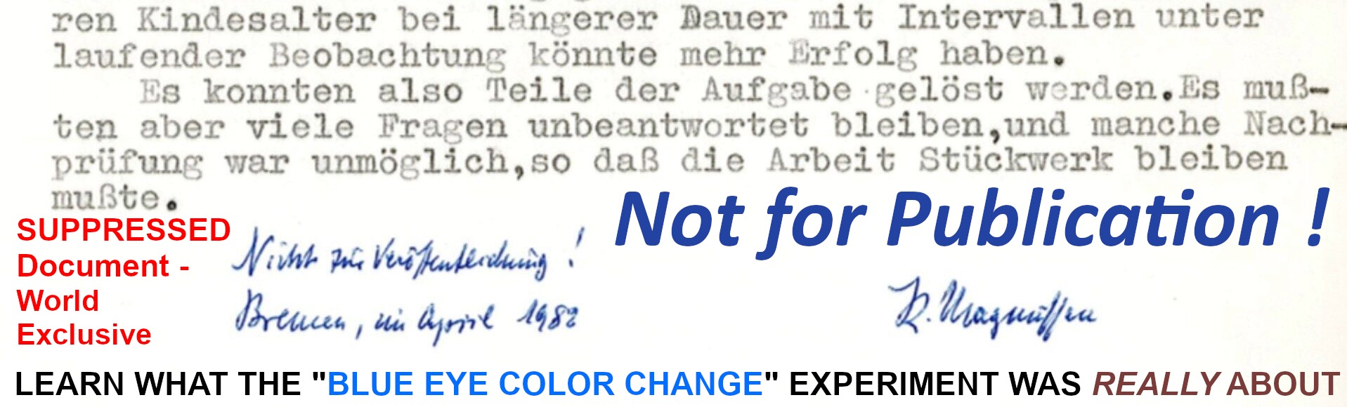 auschwitz eye color change dr josef mengele