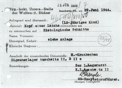 dr josef mengele 12 year old head