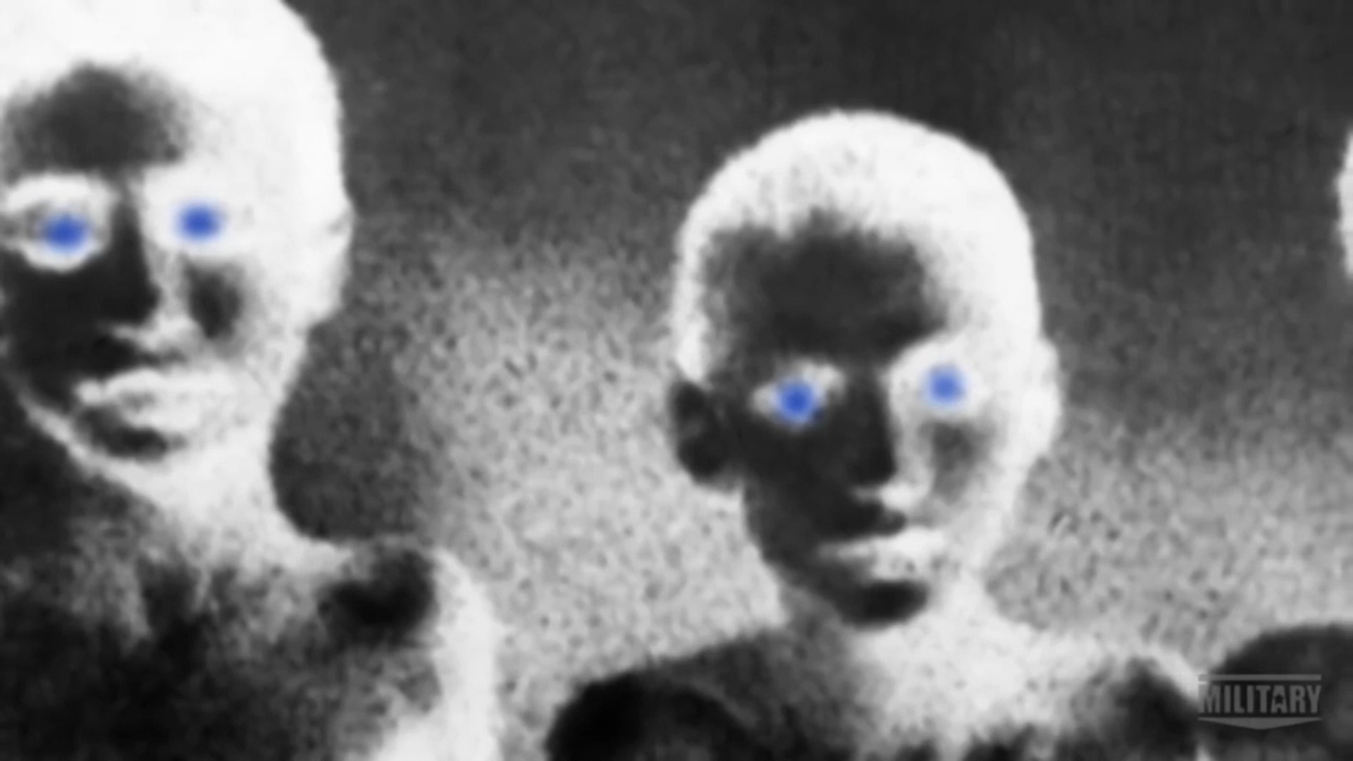 dr josef mengele blue eye color